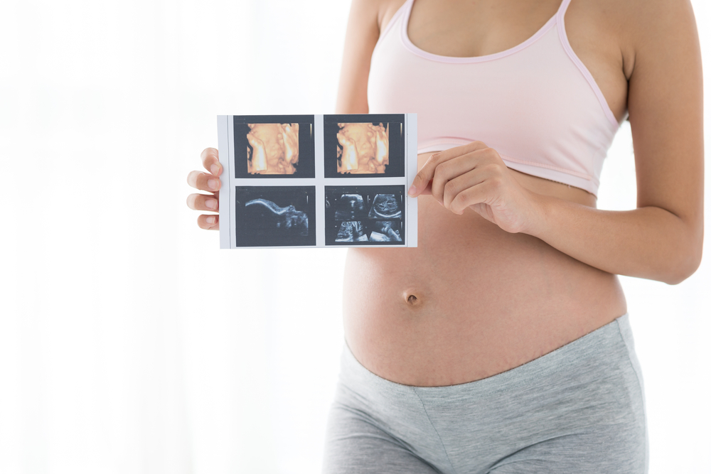2D AND 3D ULTRASOUND, Pregnancy Ultrasound in Miami